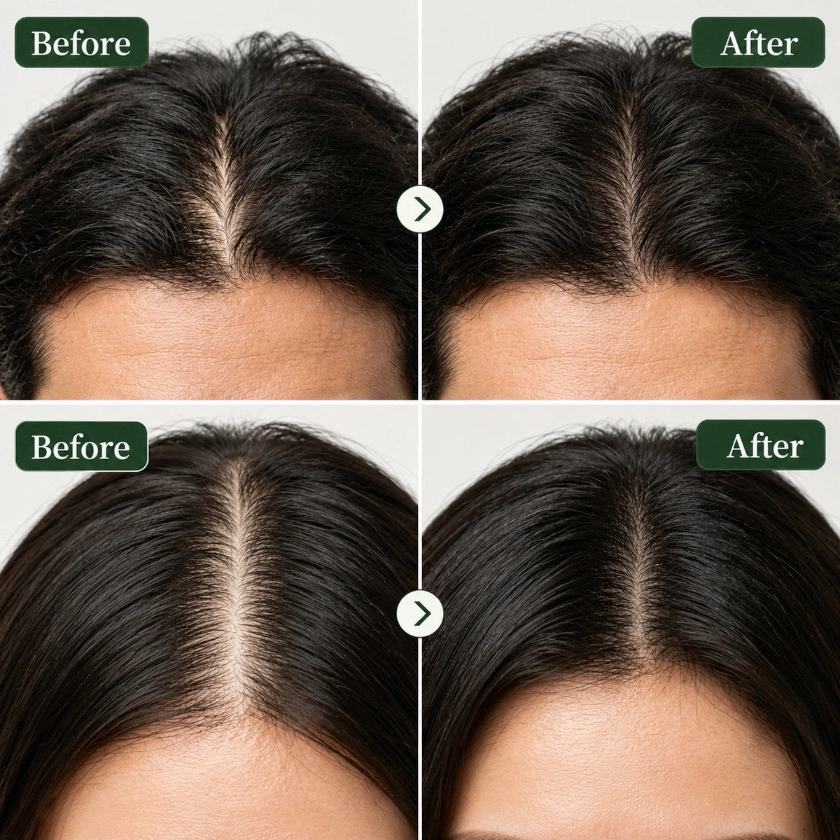 Before and after
