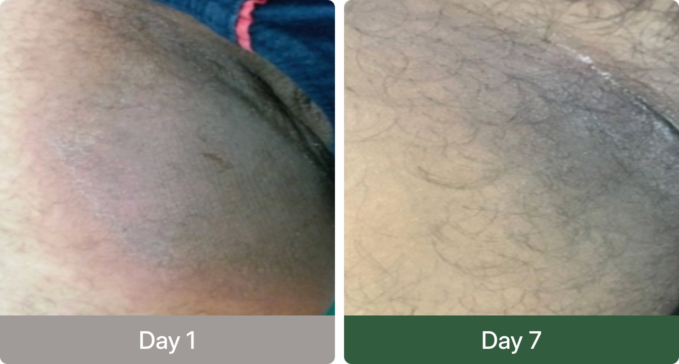 Before and after one week