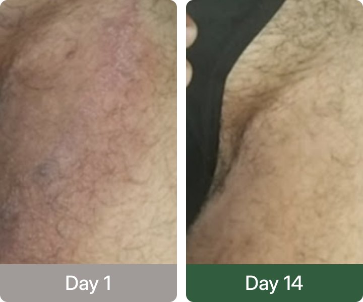 Before and after gym irritation